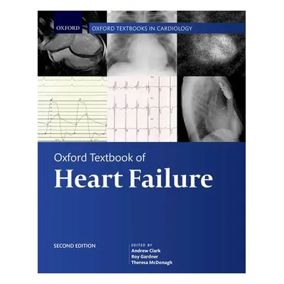 "Oxford Textbook of Heart Failure" - "" ("Clark Andrew L.")