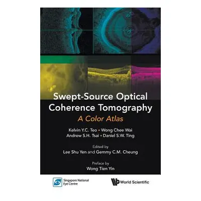 "Swept-Source Optical Coherence Tomography: A Color Atlas" - "" ("Lee Shu Yen")