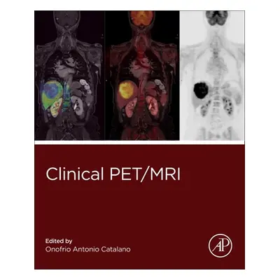 "Clinical PET/MRI" - "" ("")