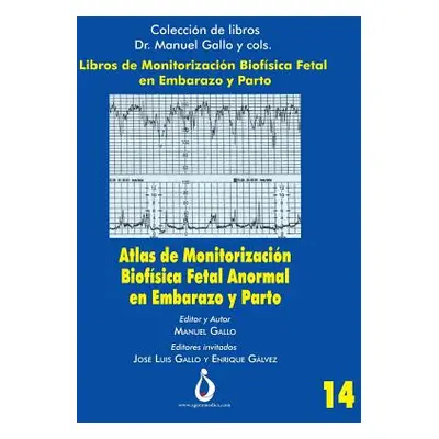 "Atlas de Monitorizacion Biofisica Fetal Anormal En El Embarazo Y Parto" - "" ("Padilla Jose")