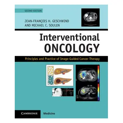 "Interventional Oncology: Principles and Practice of Image-Guided Cancer Therapy" - "" ("Geschwi