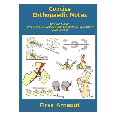 "Concise Orthopaedic Notes: Revision aid for FRCS, EBOT , SICOT and Board Examinations" - "" ("A