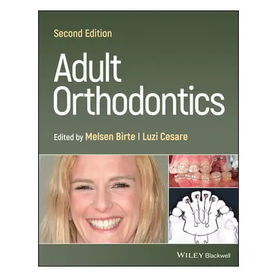 "Adult Orthodontics" - "" ("Melsen Birte")