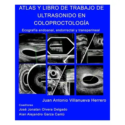 "Atlas y Libro de Trabajo de Ultrasonido en Coloproctologa" - "" ("Herrero Juan a. Villanueva")