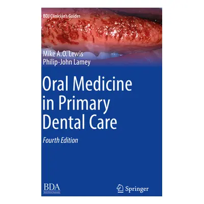 "Oral Medicine in Primary Dental Care" - "" ("Lewis Michael A. O.")