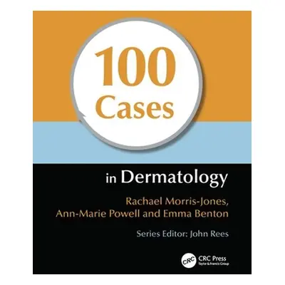 "100 Cases in Dermatology" - "" ("Morris-Jones Rachael")