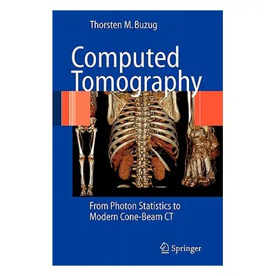 "Computed Tomography: From Photon Statistics to Modern Cone-Beam CT" - "" ("Buzug Thorsten M.")