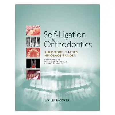 "Self-Ligation in Orthodontics: An Evidence-Based Approach to Biomechanics and Treatment" - "" (