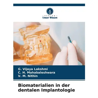 "Biomaterialien in der dentalen Implantologie" - "" ("Vijaya Lakshmi G.")