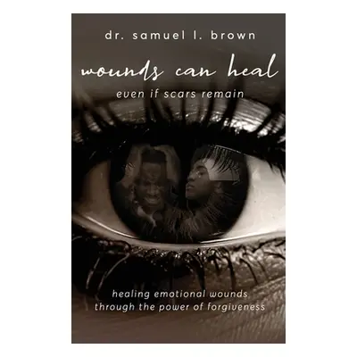 "Wounds Can Heal, Even If Scars Remain" - "" ("Brown Samuel")