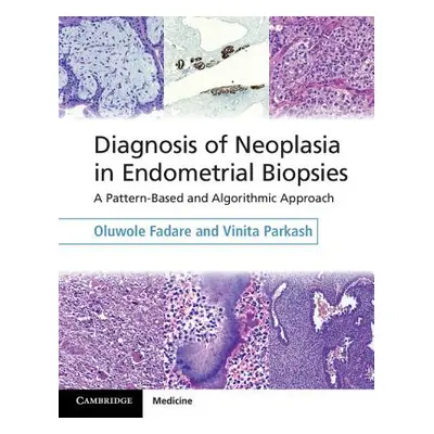 "Diagnosis of Neoplasia in Endometrial Biopsies Book and Online Bundle: A Pattern-Based and Algo