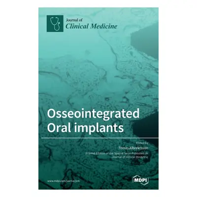 "Osseointegrated Oral implants: Mechanisms of Implant Anchorage, Threats and Long-Term Survival 