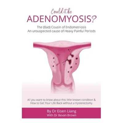 "Adenomyosis -The Bad Cousin of Endometriosis: An unsuspected cause of Heavy Painful Periods" - 