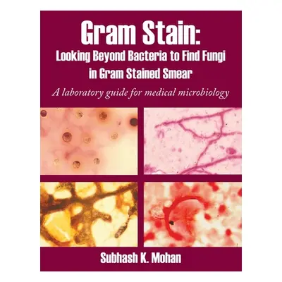 "Gram Stain: Looking Beyond Bacteria to Find Fungi in Gram Stained Smear: A Laboratory Guide for