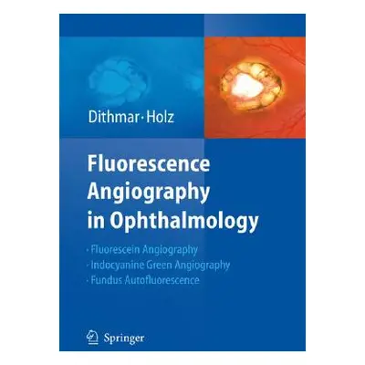 "Fluorescence Angiography in Ophthalmology" - "" ("Dithmar Stefan")