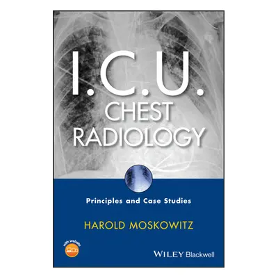 "I.C.U. Chest Radiology: Principles and Case Studies [With CDROM]" - "" ("Moskowitz Harold")