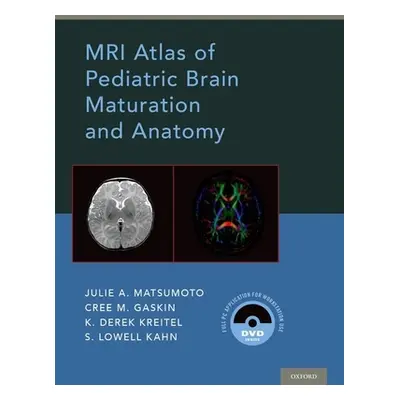 "MRI Atlas of Pediatric Brain Maturation and Anatomy" - "" ("Matsumoto Julie A.")