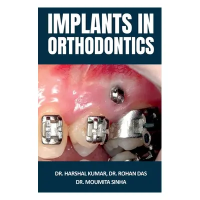 "Implants in Orthodontics" - "" ("Harshal")