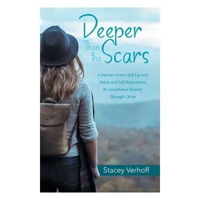 "Deeper Than the Scars: A Journey from Cleft Lip and Palate and Self-Rejection to Re-Established