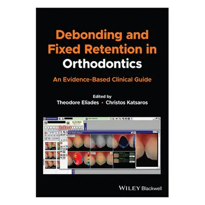 "Debonding and Fixed Retention in Orthodontics: An Evidence-Based Clinical Guide" - "" ("Eliades