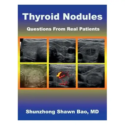 "Thyroid Nodules: Questions From Real Patients" - "" ("Winter Barbara")