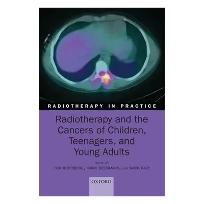 "Radiotherapy and the Cancers of Children, Teenagers and Young Adults" - "" ("Boterberg Tom")