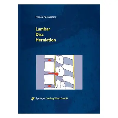 "Lumbar Disc Herniation" - "" ("Postacchini Franco")