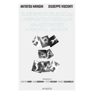 "Supermicrosurgical LymphaticoVenular Anastomosis: A Practical Textbook.: LVA Textbook" - "" ("V