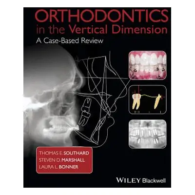 "Orthodontics in the Vertical Dimension: A Case-Based Review" - "" ("Southard Thomas E.")