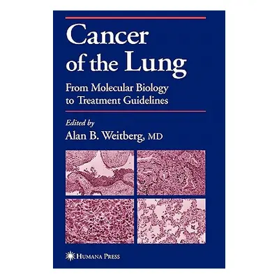 "Cancer of the Lung: From Molecular Biology to Treatment Guidelines" - "" ("Weitberg Alan")