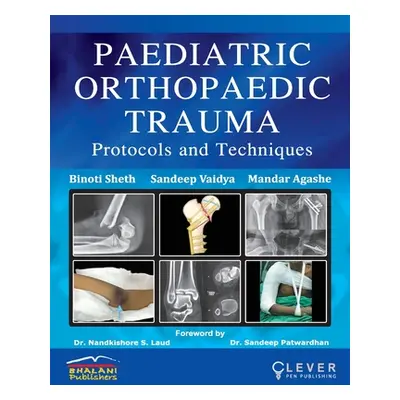 "PAEDIATRIC ORTHOPAEDIC TRAUMA Protocols and Techniques""" - "" ("Sheth Binoti")