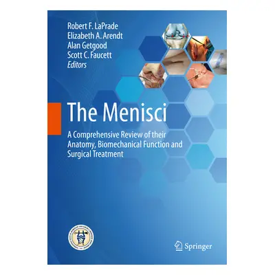 "The Menisci: A Comprehensive Review of Their Anatomy, Biomechanical Function and Surgical Treat