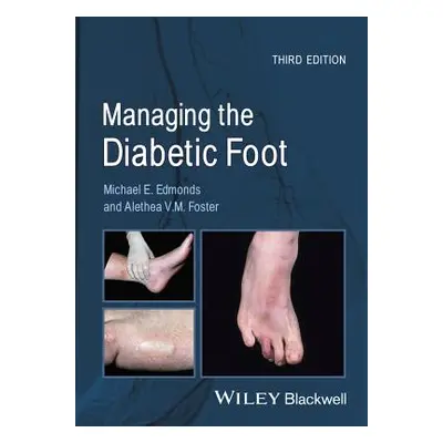 "Managing the Diabetic Foot" - "" ("Edmonds Michael E.")