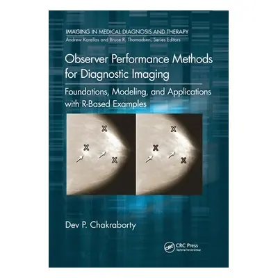 "Observer Performance Methods for Diagnostic Imaging: Foundations, Modeling, and Applications wi