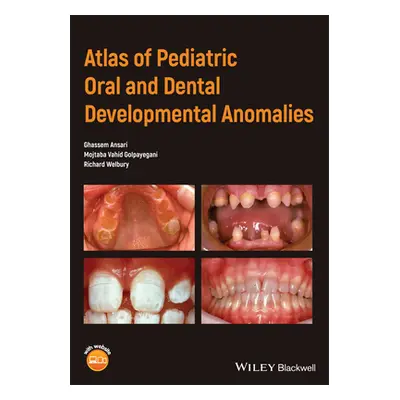 "Atlas of Pediatric Oral and Dental Developmental Anomalies" - "" ("Ansari Ghassem")