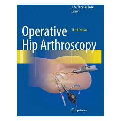 "Operative Hip Arthroscopy" - "" ("Byrd J. W. Thomas")