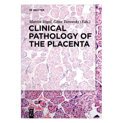 "Clinical Pathology of the Placenta" - "" ("Vogel Martin")