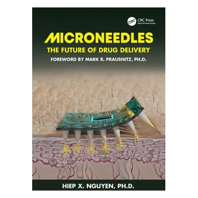 "Microneedles: The Future of Drug Delivery" - "" ("Nguyen Hiep Xuan")