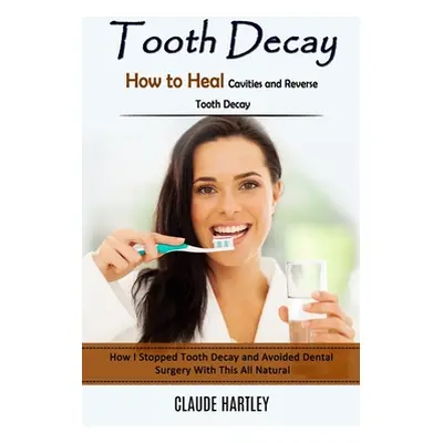 "Tooth Decay: How to Heal Cavities and Reverse Tooth Decay