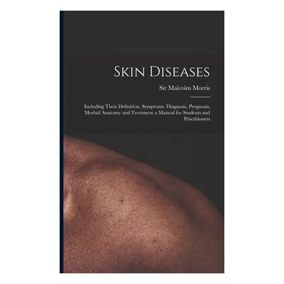 "Skin Diseases [electronic Resource]: Including Their Definition, Symptoms, Diagnosis, Prognosis