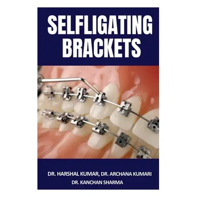 "Selfligating Brackets" - "" ("Harshal")