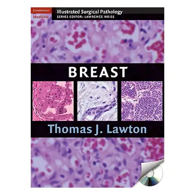 "Illustrated Surgical Pathology of the Breast [With CDROM]" - "" ("Lawton Thomas")