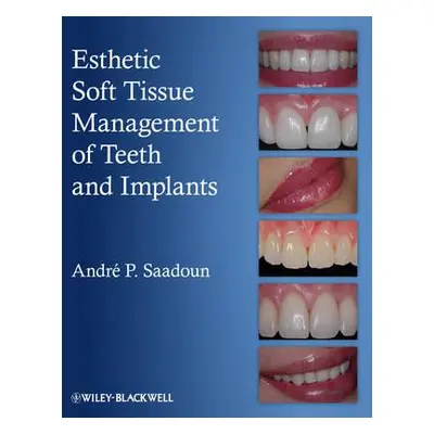 "Esthetic Soft Tissue Management of Teeth and Implants" - "" ("Saadoun Andre P.")