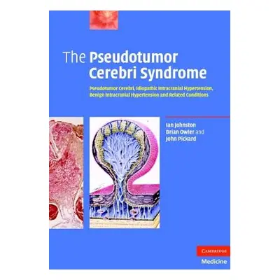 "The Pseudotumor Cerebri Syndrome" - "" ("Johnston Ian")