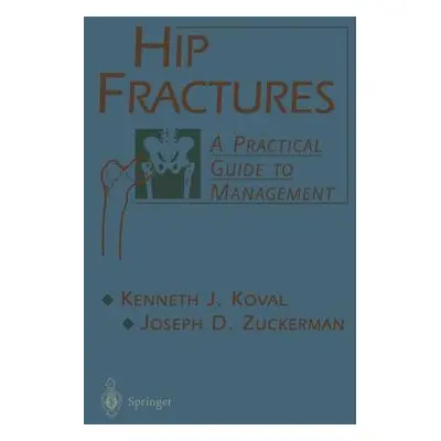 "Hip Fractures: A Practical Guide to Management" - "" ("Koval Kenneth")