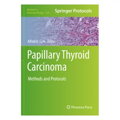 "Papillary Thyroid Carcinoma: Methods and Protocols" - "" ("Lam Alfred K.")