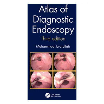 "Atlas of Diagnostic Endoscopy, 3e" - "" ("Ibrarullah Mohammad")