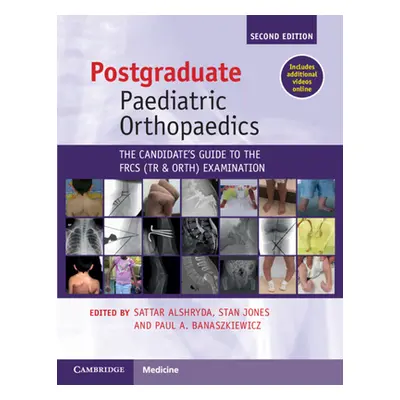 "Postgraduate Paediatric Orthopaedics: The Candidate's Guide to the Frcs(tr&orth) Examination" -