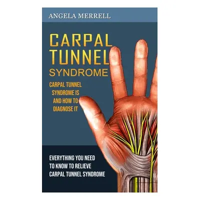 "Carpal Tunnel Syndrome: Carpal Tunnel Syndrome is and How to Diagnose It