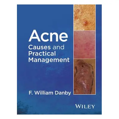 "Acne: Causes and Practical Management" - "" ("Danby F. William")